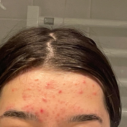 🌹 Lumerasskin Rosenwasser mit Glycerin